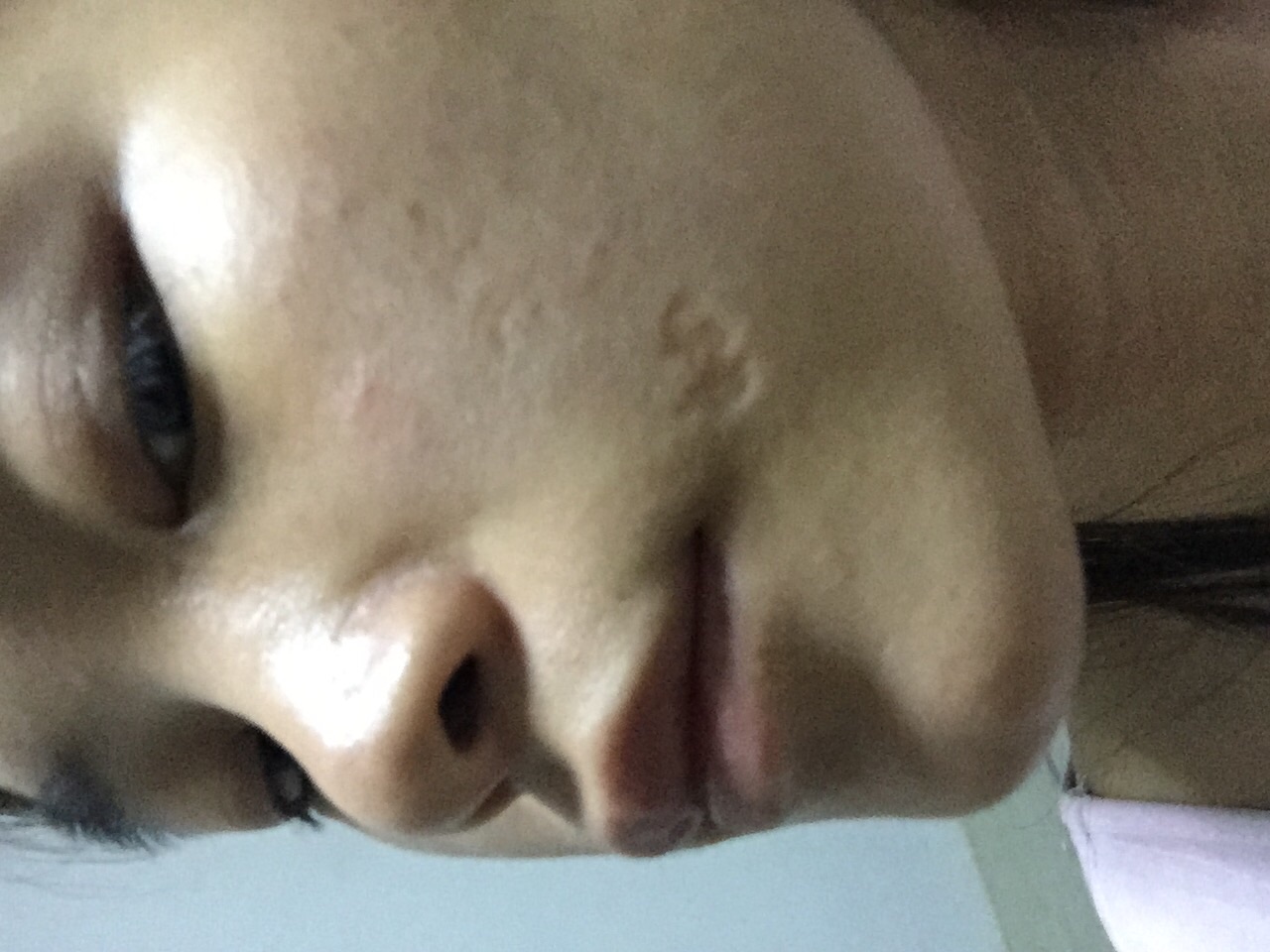 有哪些对你有特殊意义的疤痕？可以说说吗？