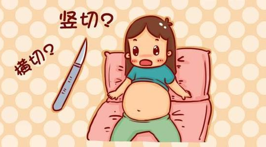 为啥一些产妇宁愿在肚皮上“挨”一大刀，也不肯被“侧切”一小刀呢？
